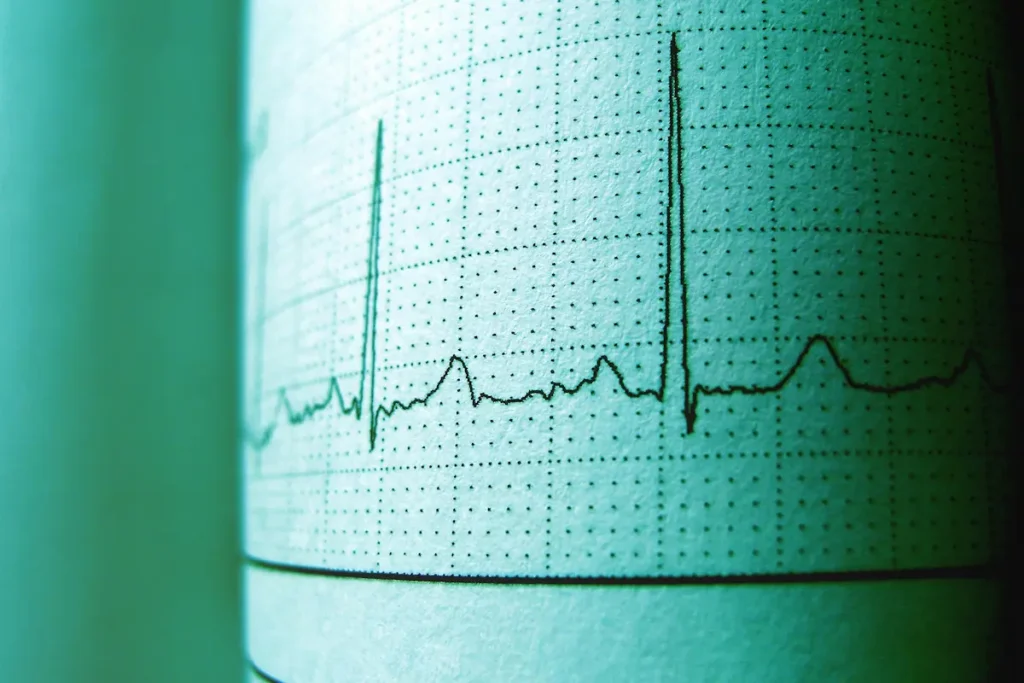 καρδιογράφημα